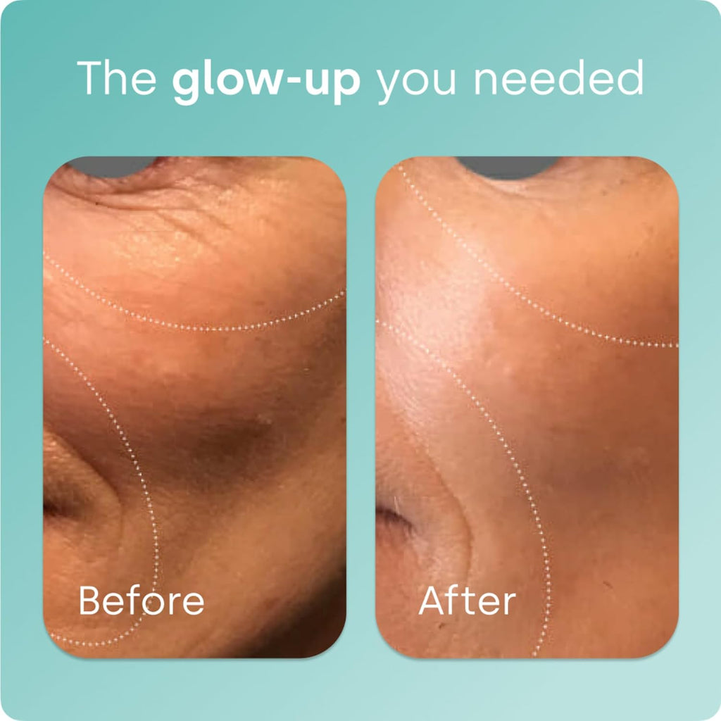 Biosil Collagen Generator with ch-OSA help generate collagen 120 Capsules